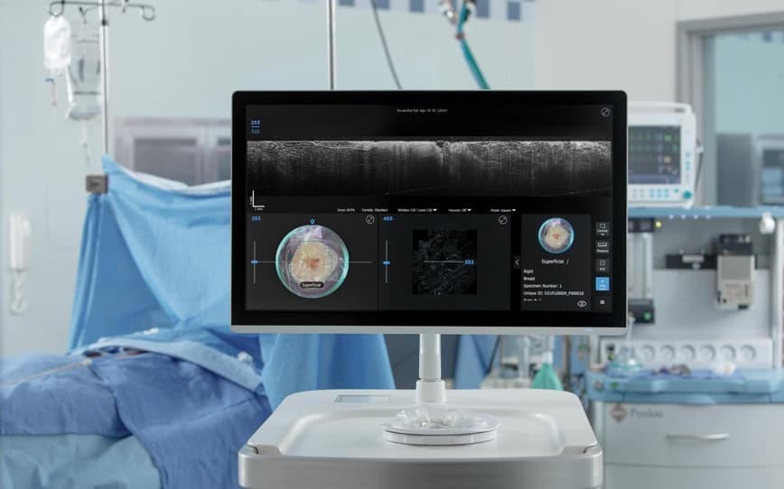 Perimeter Medical Imaging AI confirms positive outcomes from study of artificial intelligence technology on breast cancer surgeries